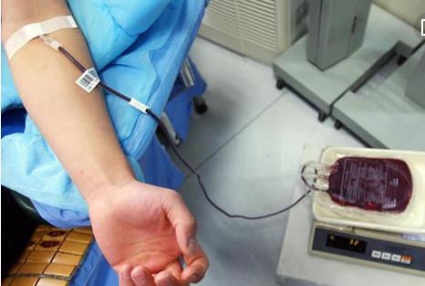 献血或抽血后为什么会出现淤青？