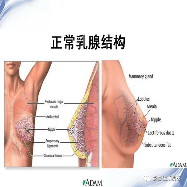 乳腺钙化的钼靶X线鉴别诊断